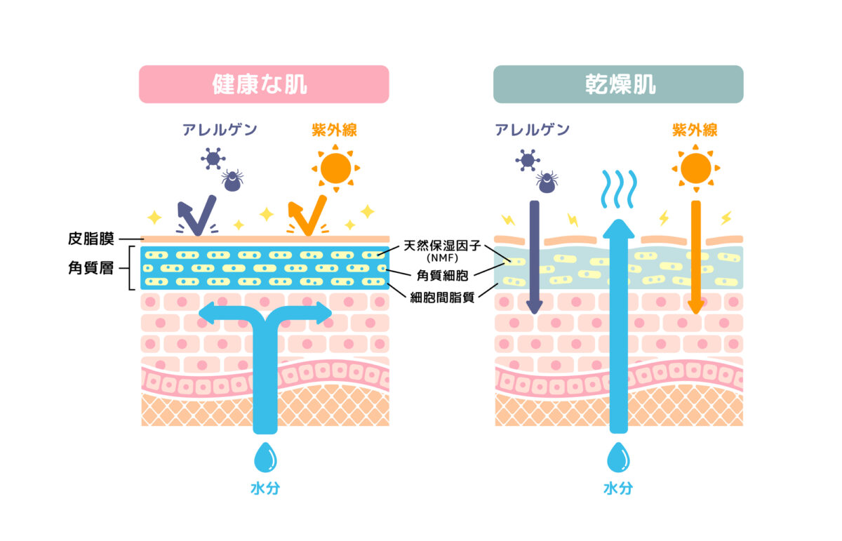 見逃し注意な「肌の乾燥サイン」とは?正しいスキンケアで今すぐ対策!